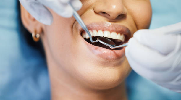 Best Emergency Tooth Extraction in Boronda, CA