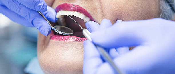 Best Same-Day Emergency Dental Services in Boronda, CA